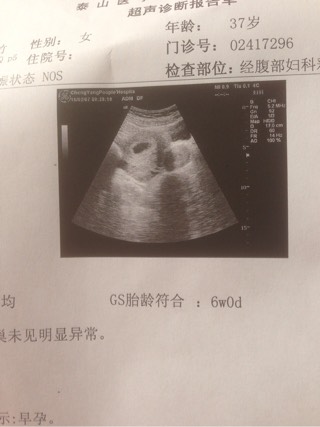 预产期计算器在线计算器